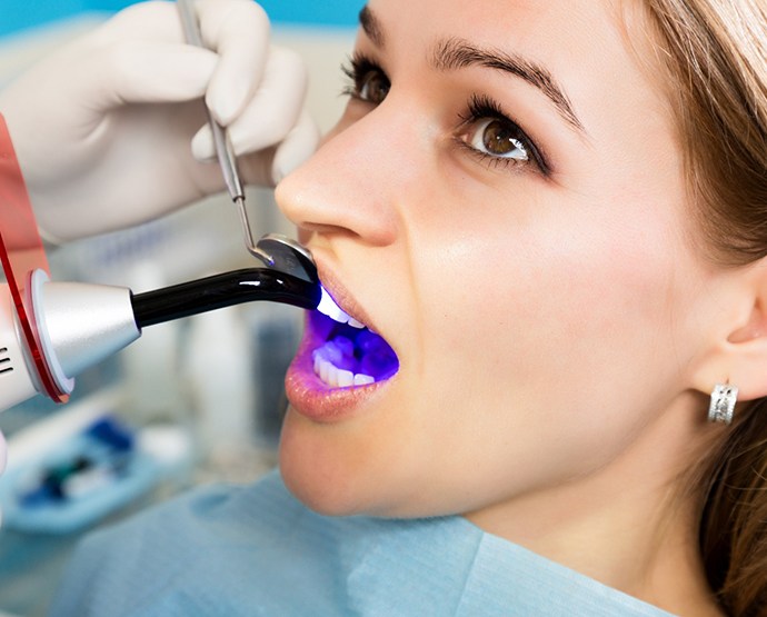 Dentist demonstrating cosmetic bonding on large model tooth