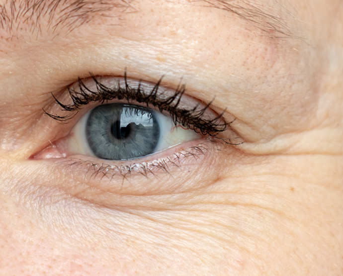 Close up of wrinkles around eye