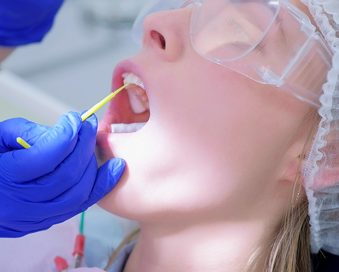 Dentist opening mouth for fluoride treatment