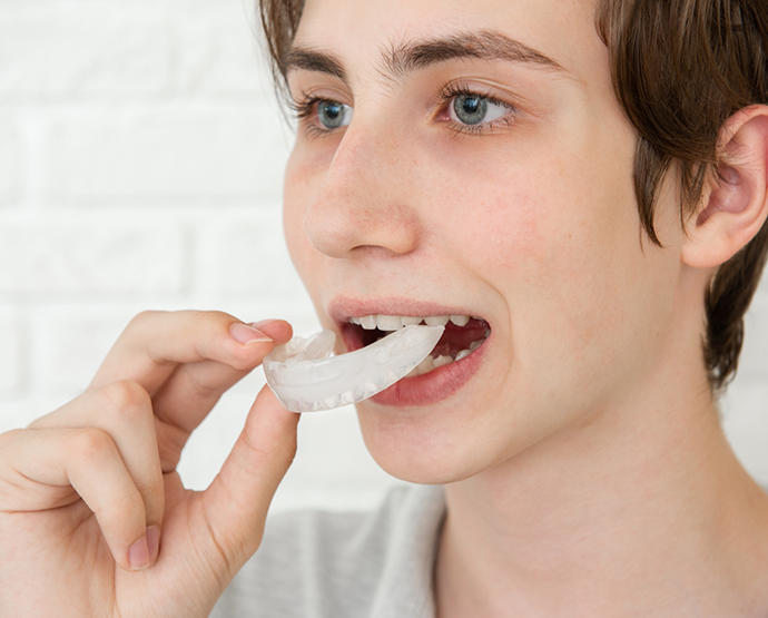 Close up of person putting in a mouthguard