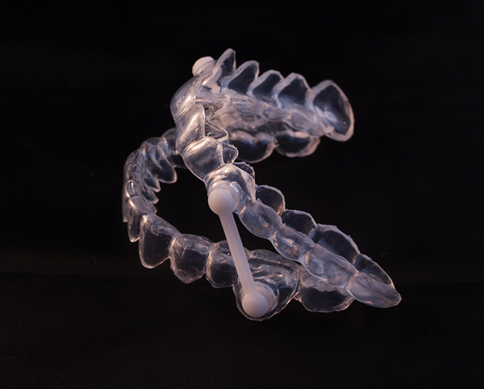 Close up of oral appliance for treating sleep apnea in St Augustine