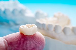 Tooth-colored dental crown on fingertip with model jaw in background